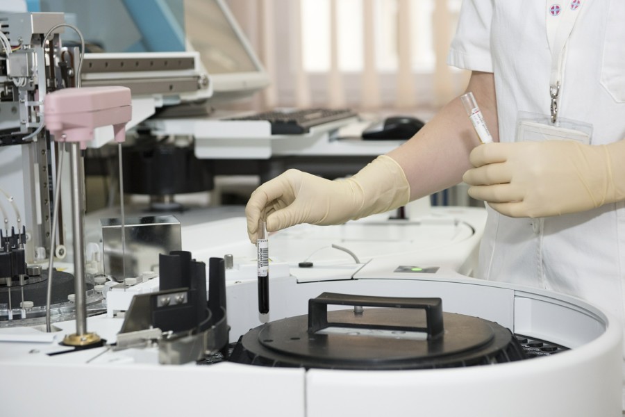 SEDAM MEDICINSKIH OTKRIĆA KOJA DAJU NADU Među njima i novi lek za Alchajmerovu bolest