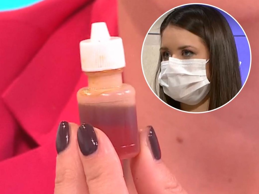 UBIJA BAKTERIJE, SPAS JE PROTIV KANDIDE: Evo za šta je dobar propolis i koje sve vrste postoje!