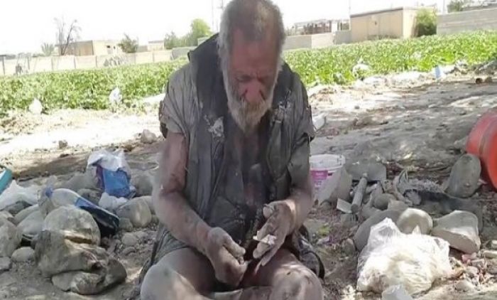 DOKTORI SU POSETILI "NAJPRLJAVIJEG" ČOVEKA NA SVETU I OSTALI U ČUDU! Nije se okupao 67 godina: (FOTO/VIDEO)