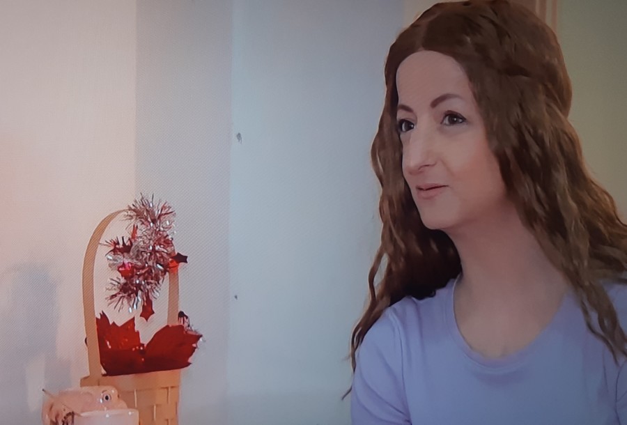 RETKE BOLESTI: Od progerije, bolesti prevremenog starenja, boluju samo 4 žene u svetu. Jedna je u Srbiji!